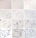 Stress-Induced-phosphoprotein 1 (STIP1) Stress-Induced-phosphoprotein 1 (STIP1)