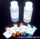 ACA ELISA Kit ACA ELISA Kit