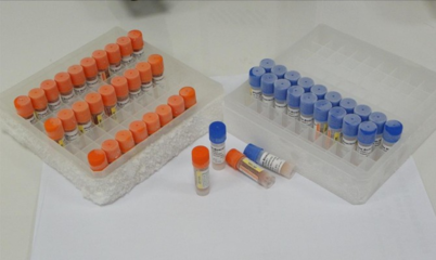 Aflatoxin M1(AFM1)ELISA kit