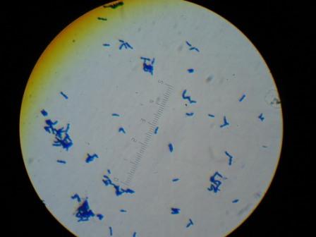 Bifidobacterium adolescentis Bifidobacterium adolescentis