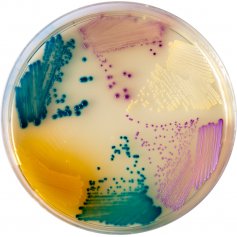 Chromoagar Orientation