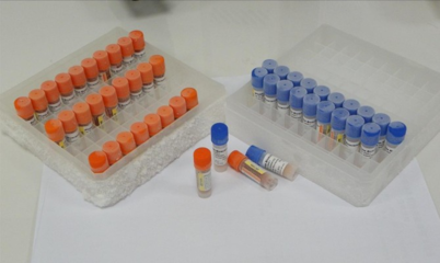 Human Serotransferrin ELISA kit