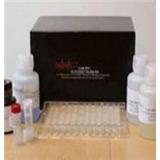 Human lumican ELISA Kit Human lumican ELISA Kit