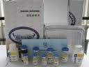 Human vimentin,VIM ELISA Kit Human vimentin,VIM ELISA Kit
