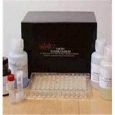Lumican ELISA kit Lumican ELISA kit