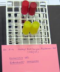 Methyl red voges proskauer medium X8 MR-VP